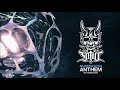2019 Silaver SOTUI Anthem