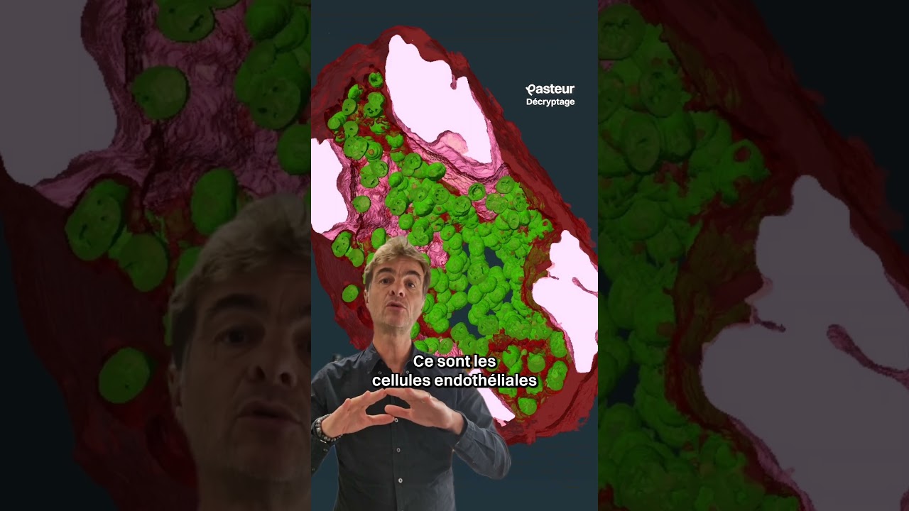 Méningite : le voyage en 3D