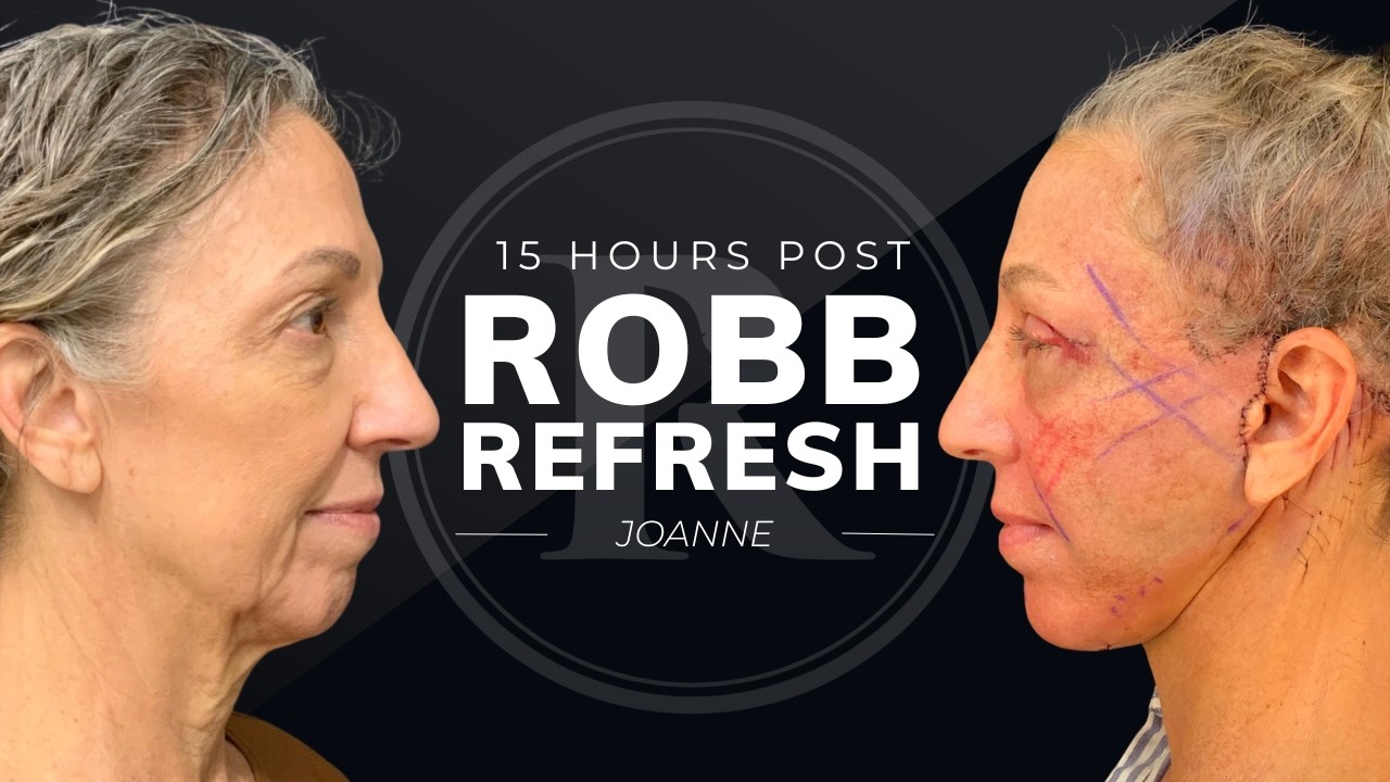 Robb Facial Plastic Surgery