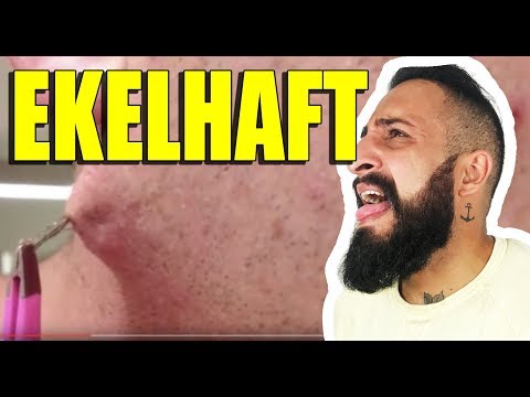 Das gibt Schmerzen von der Hüfte Ð »ÐμÑ ‡ ÐμниÐμ поР· ‡ Ð²Ð¾Ð½Ð¾Ñ Ð½Ð¸ÐºÐ ° оР± л Ð ° Ñ Ð ± оРÑ, ной »ÑŒÐ½Ð¸Ñ † d & mgr;