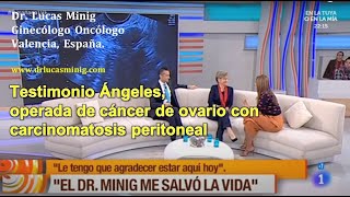 ✅ Cáncer de Ovario - Testimonio Ángeles Vera -  Dr  Lucas Minig Ginecólogo Oncólogo Valencia, España