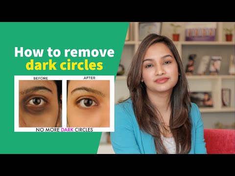 Under Eye Dark Circles | Dark Circles Treatment | Undereye Dark Circles Causes | Dr Jyoti Gupta MD