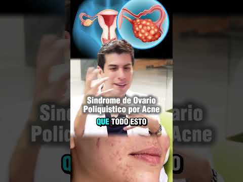 Juan Herrera Hernández-65