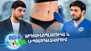 Բուժ ինֆո/Buj Info/ Գլխավոր /Աբդոմինոպլաստիկա և լիպոմոդելավորում. ժամանակակից մոտեցումներ