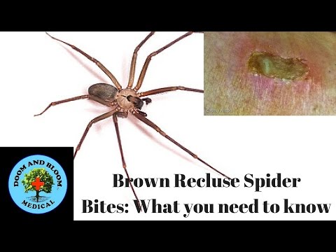 Brown Recluse Spider Bites: What you need to know