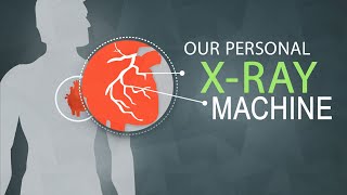 Our Personal X-Ray Machine