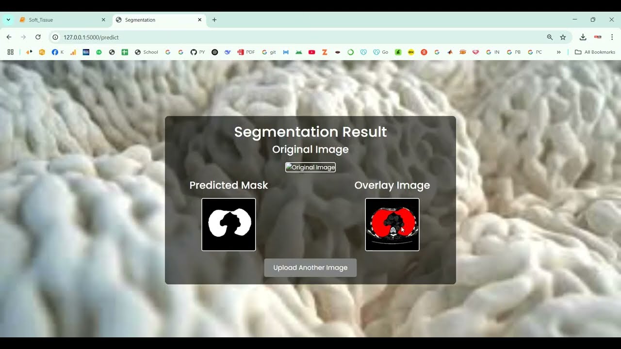 Soft Tissue Segmentation using Image Dataset in Python Projects