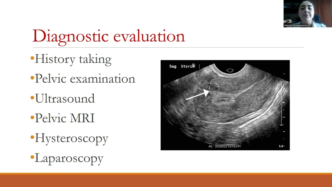 Uterine fibroids. Endometriosis