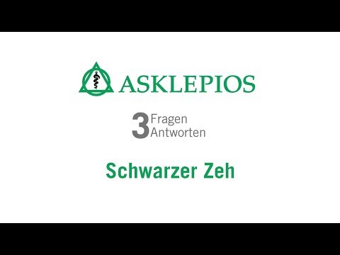 Schwarzer Zeh: 3 Fragen 3 Antworten | Asklepios