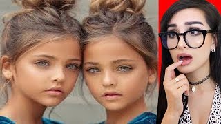 THESE TWINS SHARE EVERYTHING