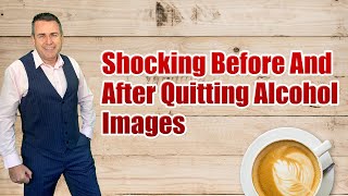 Shocking Before And After Quitting Alcohol Images