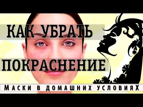 Пигментные пятна на лице у мужчины причины лечение Лимон и перекись для отбеливания лица