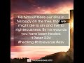 Healing Bible Verse | 1 Peter 2:24 By his wounds you have been healed #bibleverse #healing #shorts