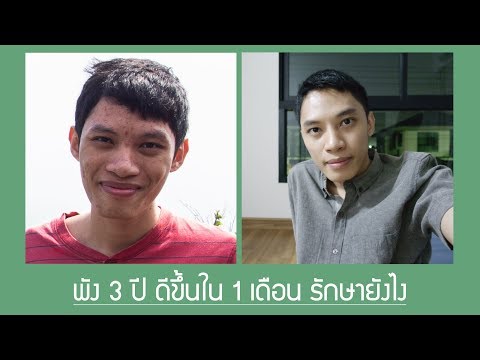 แฮงค์ซิลิโคนเต้านม ผมอายุ 16 ปีและฉันมีหน้าอกเล็ก