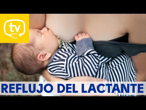 El reflujo en el bebé lactante