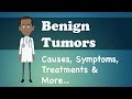 Benign Tumors Causes Symptoms Treatments More
