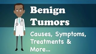 Benign Tumor