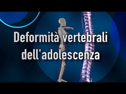 Forte dolore al ginocchio quando si gira Ernia del rachide cervicale della colonna vertebrale lagopuntura