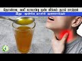 தொண்டையில் கரகரப்பு எரிச்சல் புண் வீ