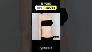 팔뚝 뭐 했대....??? #shorts