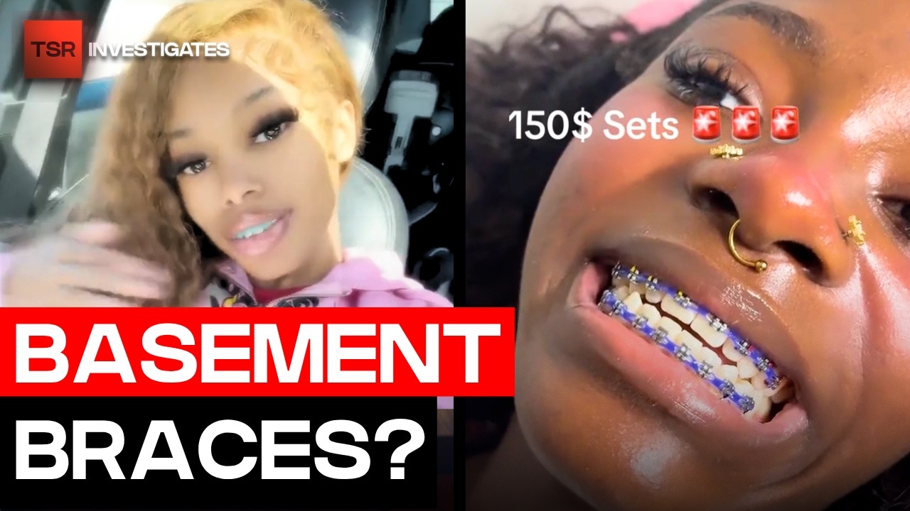 “Basement Braces” Are Going Viral And Dentists Are Concerned | TSR Investigates