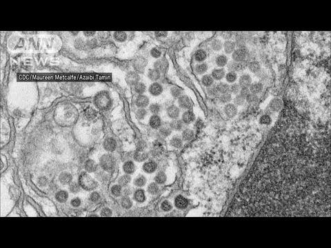 macOS: 新しいウイルスがすべてのデータを読み取ります – 言語設定によりウイルスから保護されます