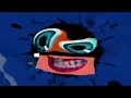 SEIZURE WARNING Respondview 2