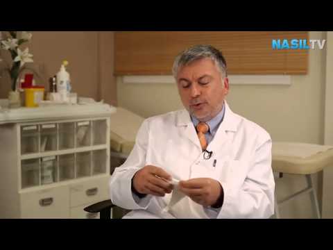 , title : 'Göbek fıtığı ameliyatı nasıl yapılır  videolu anlatım   NASIL TV'