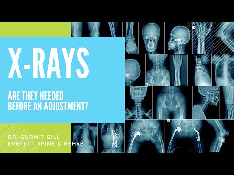 Are x-rays necessary for a chiropractic adjustment?