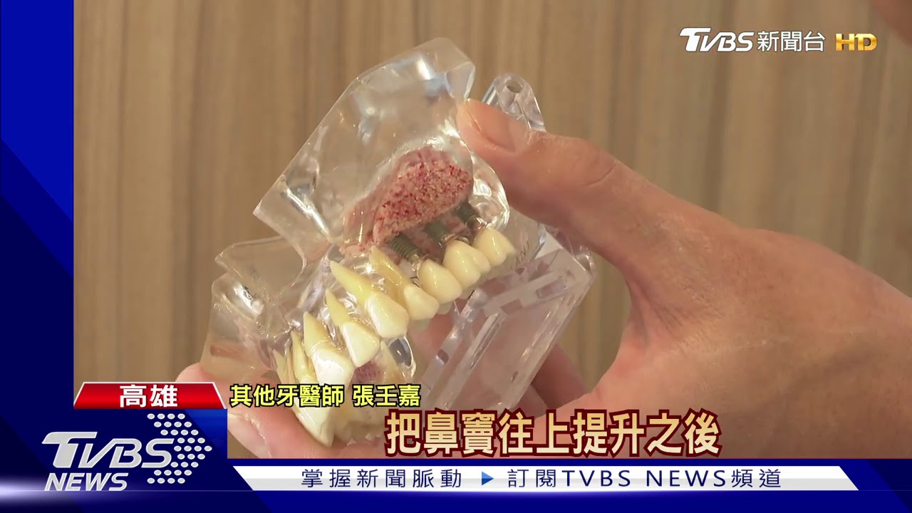 花25萬植牙卻貫穿顎竇　病患喝水鼻子流出才知