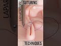 Laparoscopic Suturing Techniques Shorts Tech Suture Training Laparoscopy Medical Medicine
