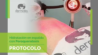 ¡LA ÚLTIMA INNOVACIÓN EN CUIDADO DE LA PIEL: POROQUERATOSIS CON PULPO INFRARROJO!