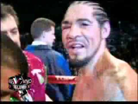 SuperXclusivo - La pegada de niña de Cotto