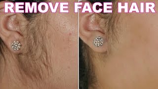 How To Remove Facial Hair Naturally | SkinCare Home Remedy | ShrutiArjunAnand
