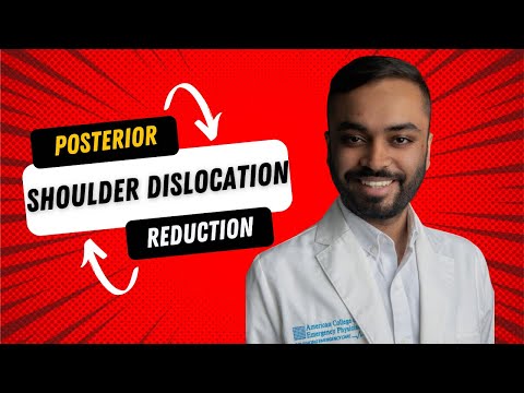 HOW TO REDUCE POSTERIOR SHOULDER DISLOCATION #emergency#trauma#ortho#shoulderdislocation 