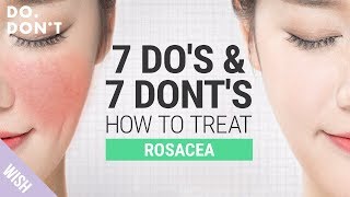 14 Tips for Rosacea That Really Work | Effective Skin Care Tips for Rosacea | Do & Don
