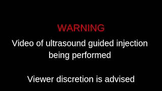 Ultrasound Guided Injection