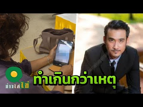 ฉันมีขนหน้าอกเล็ก ๆ น้อย ๆ เต้านม implants 325 มล.