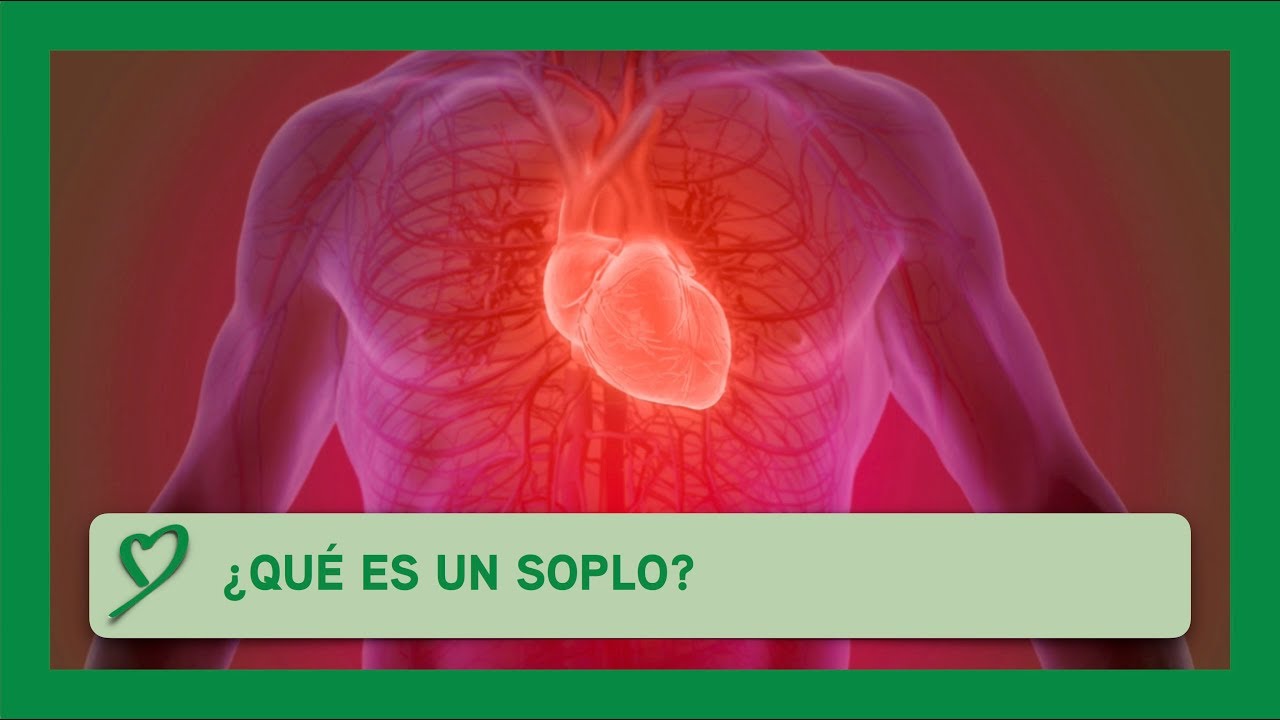 ¿Qué es un SOPLO