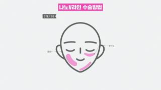 얼굴지방흡입후기 #턱지방흡입 #볼지방흡입 #뷰티라인 #나노브이라인