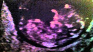 Brother Ali Walking Away Instrumental with hook