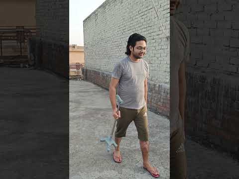 tibia surgery recovery after 240 days #tibia