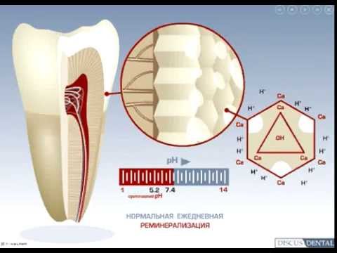 Отбеливание укреляет зубы