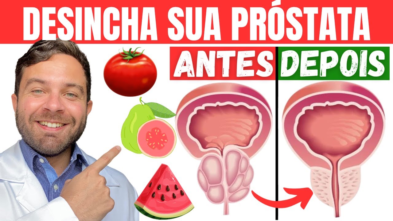 EAT THIS to DESIGNER ENLARGED PROSTATE | Natural remedy for BENIGN PROSTATIC HYPERPLASIA