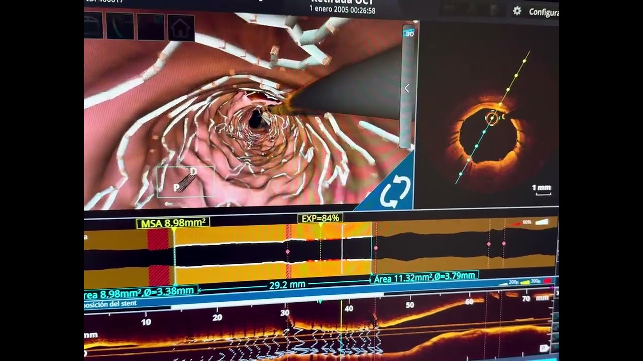 Oscar Arturo Lozano Cruz-5