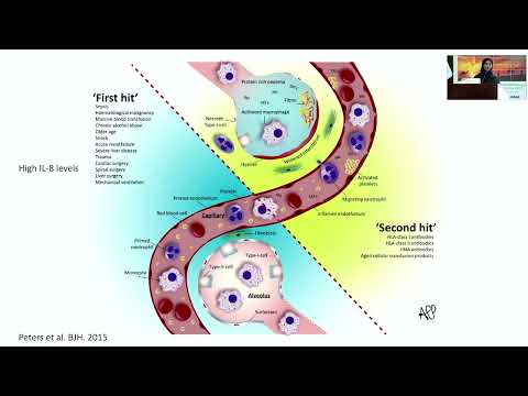 An update on respiratory transfusion reactions – Dr. Maha Badawi (September 15-16, 2023)