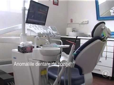 Anomaliile dentare de poziţie