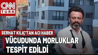 Serhat Kılıç Evinde Ölü Bulundu! Göz Çevresi, Kol ve Bacaklarında Morl