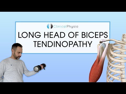 Long Head Biceps Tendinopathy | Expert Physio Review