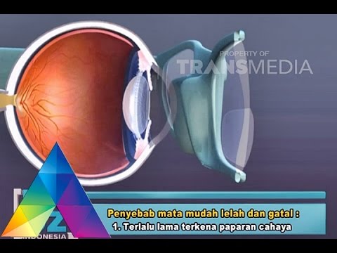 DR OZ INDONESIA 14 NOV 2015 - Penyebab Mata Mudah Lelah